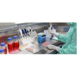 Lipid Panel 1400